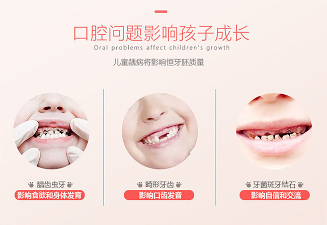 懶貝貝360°兒童電動牙刷4_04.jpg 懶貝貝360°兒童電動牙刷4_04.jpg