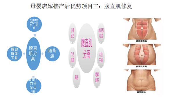 少林永化堂產后項目-腹直肌修復